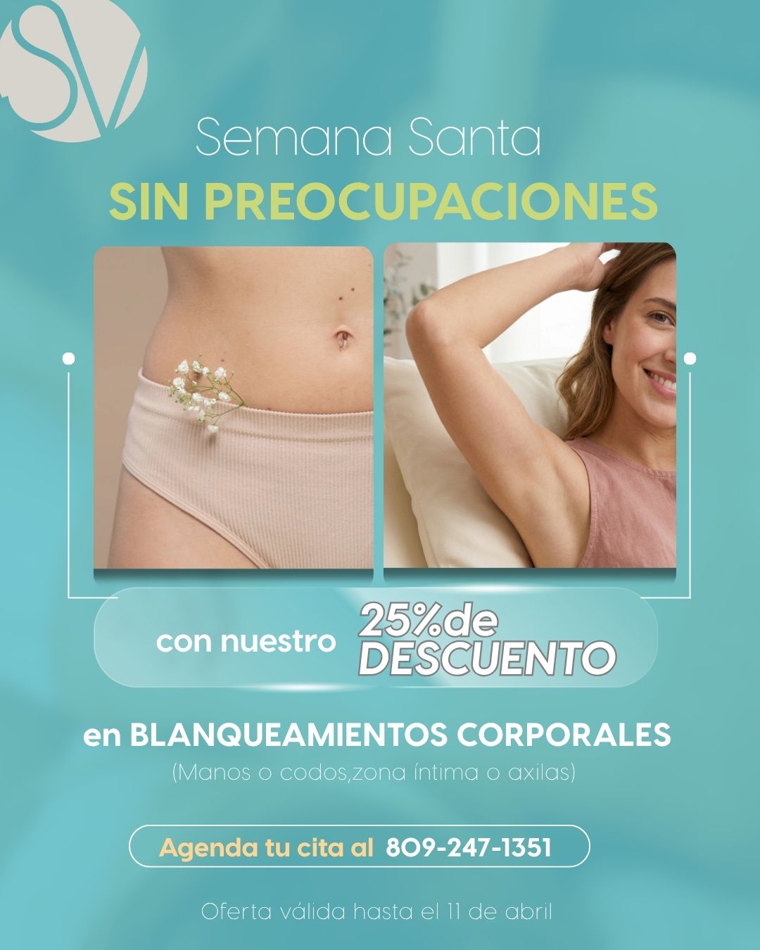 Blanqueamientos corporales