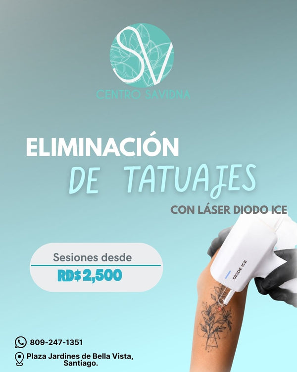 Eliminación de tatuajes